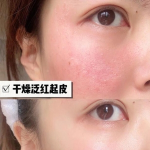 奔四女性，保持这几个好习惯，能让“肌肤”更加细腻白皙显年轻！